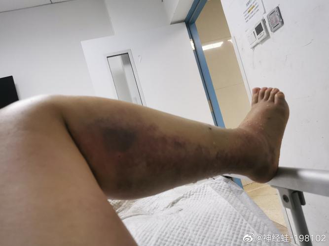 澳门科技大学金融科技硕士和女子遭毒蛇咬伤身亡与女子遭毒蛇咬伤身亡视频